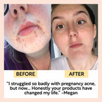 Cleanse, Tone + Moisturize Set