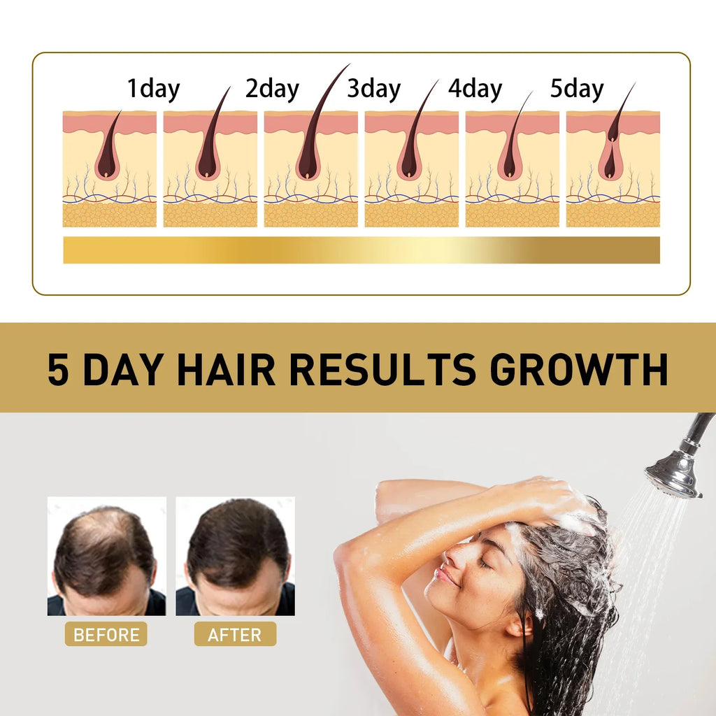 Ginger Regrowth Shampoo Anti Hair Loss Oil Control Dandruff Removal Moisturiz Nourish Scalp Repair Damaged Hair Growth Shampoo