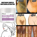 Body Whitening Cream Private Parts Underarm Bleaching Serum Whiten Butt Knee Brighten Inner Thigh Intimate Dark Remove Melanin